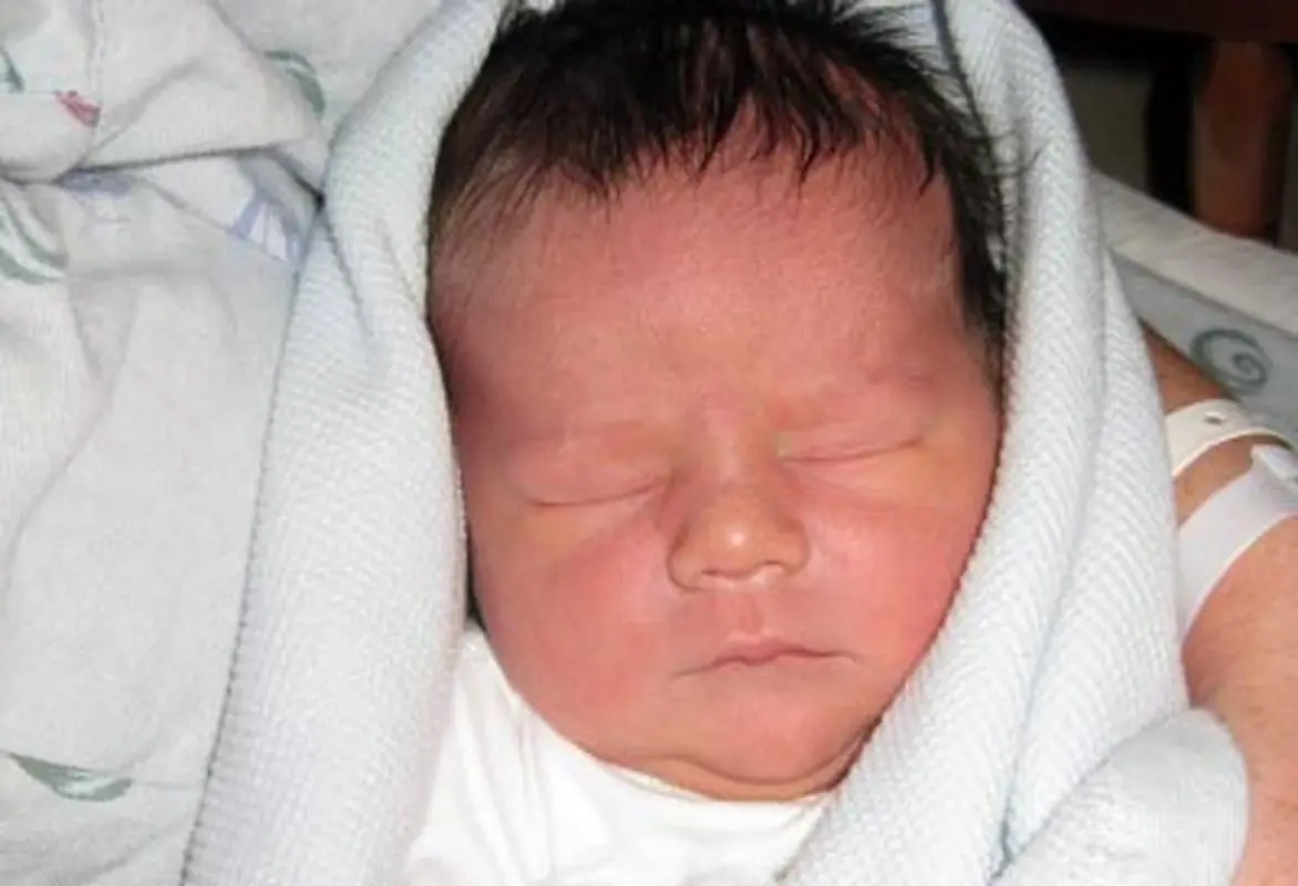 اثرات بیماری دیابت در بارداری