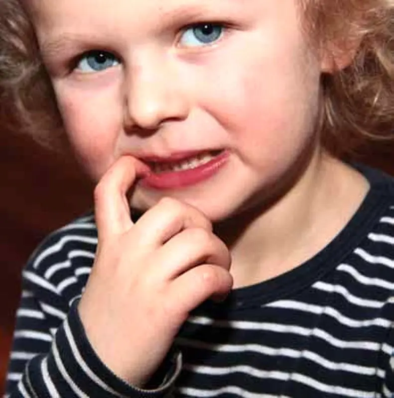 مکیدن انگشت در کودکان، نشانه چیست؟