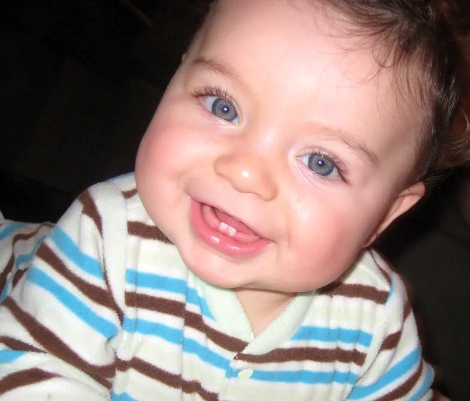 مراقبت از دندان کودک، همراه با کنترل رژیم غذایی