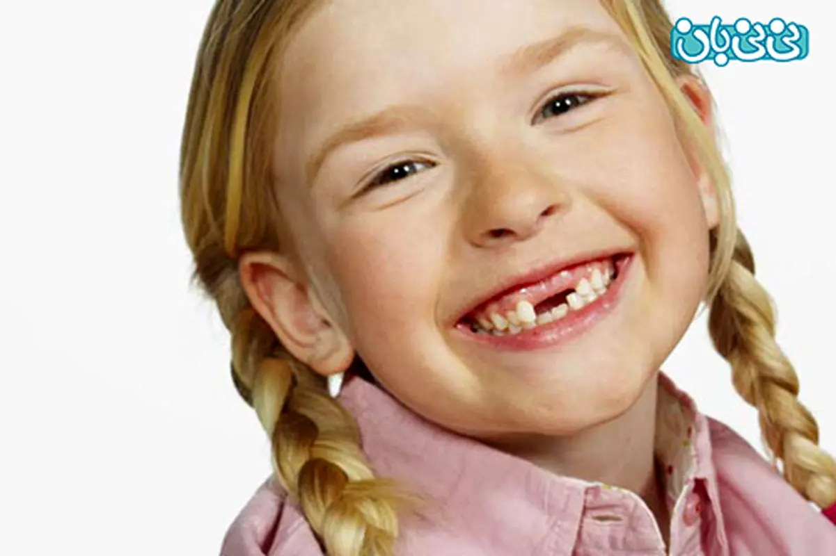 چرا دندان کودک، کج و کوله می شود؟