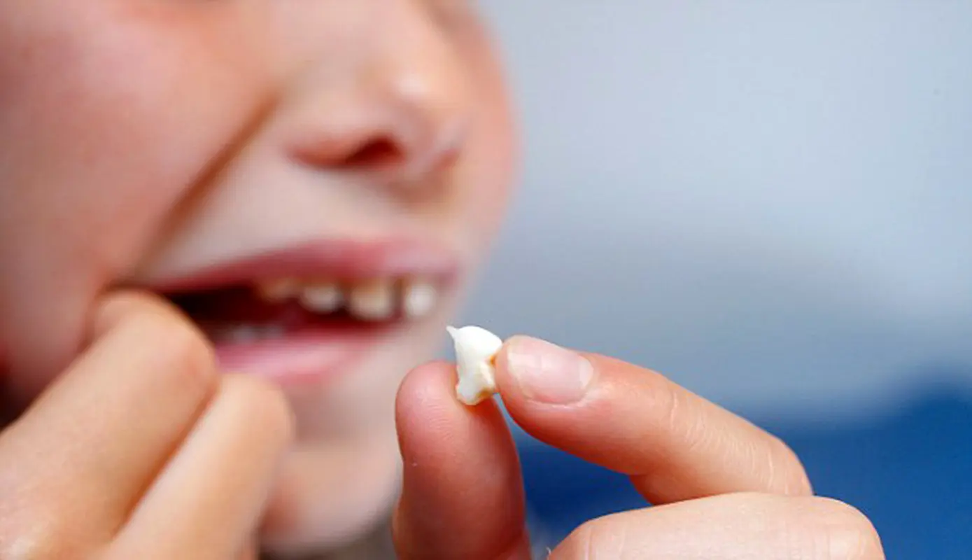 شکستگی دندان کودکان، چکار کنیم؟