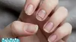 علت شکننده بودن ناخن‌ها و راه‌های درمان آن