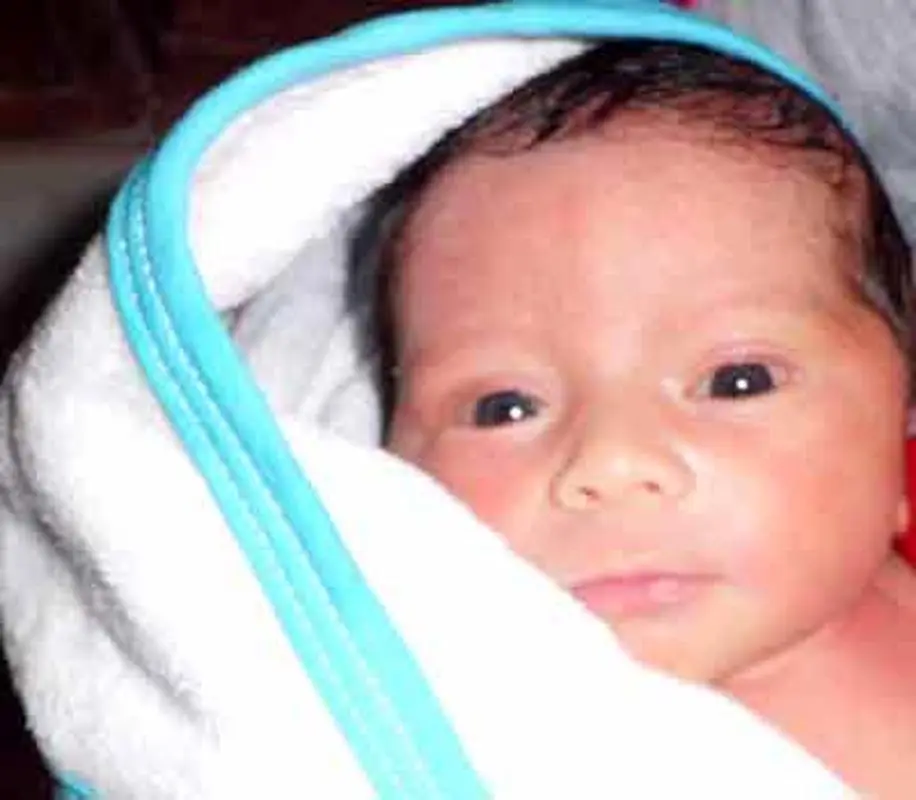 ریزش پوست سر نوزادان، هفت راه برای درمان