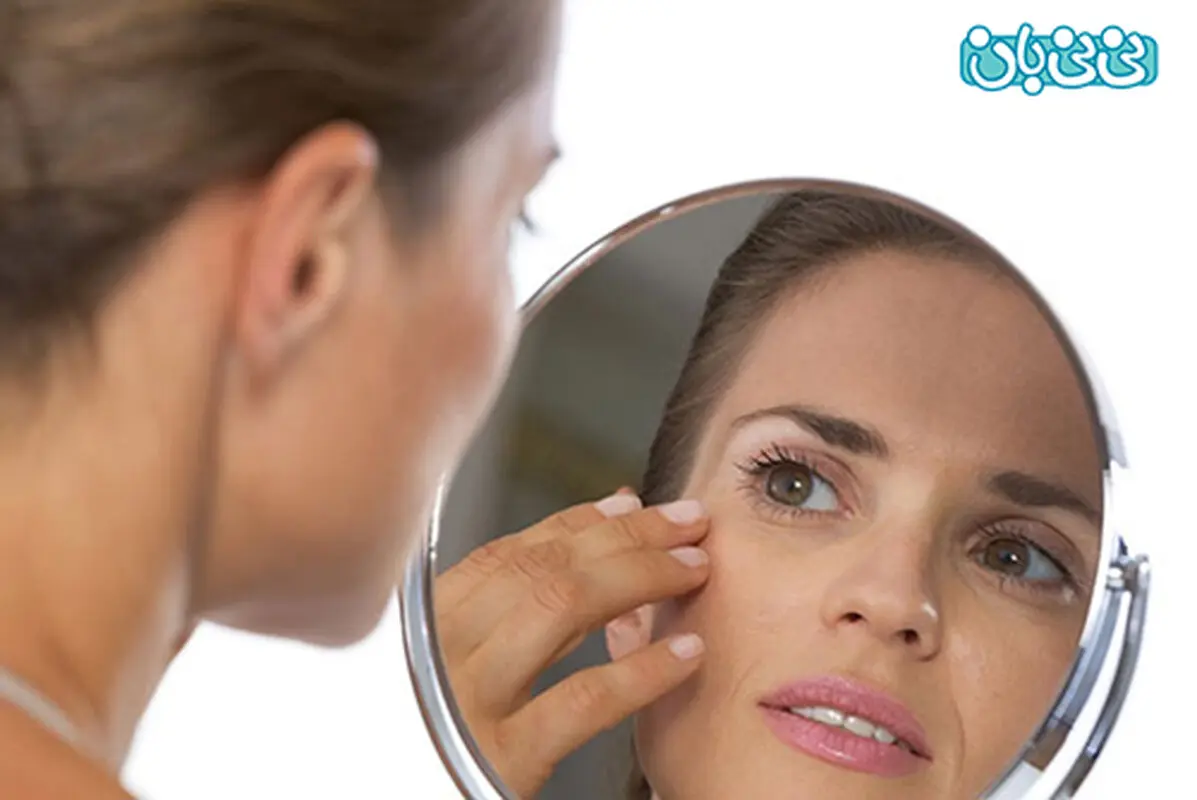 لک‌های حاملگی را چگونه درمان کنیم؟