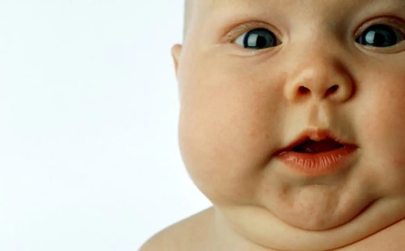 عوارض چاقی در کودکی، چرا نگران‌کننده است؟