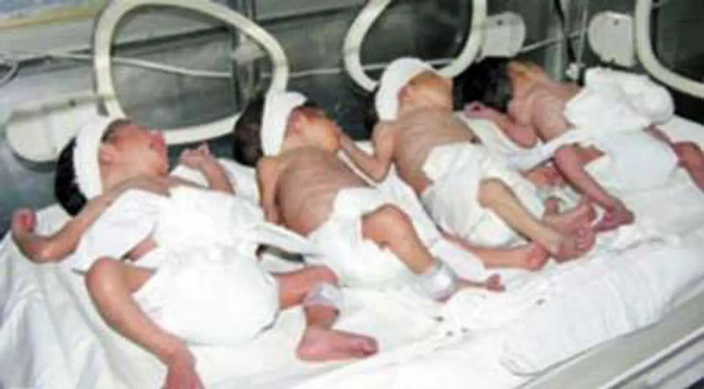 تولد چهارقلوها در همدان، هدیه خدا