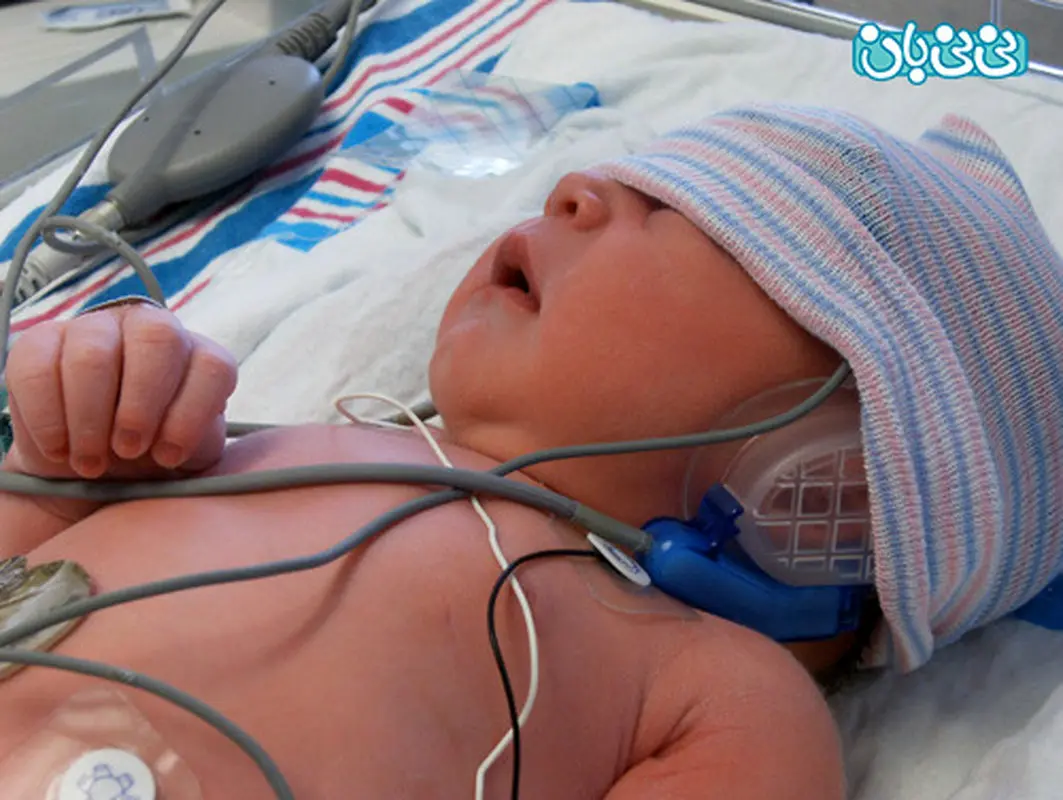 زردی نوزاد چه زمانی خطرناک میشود؟