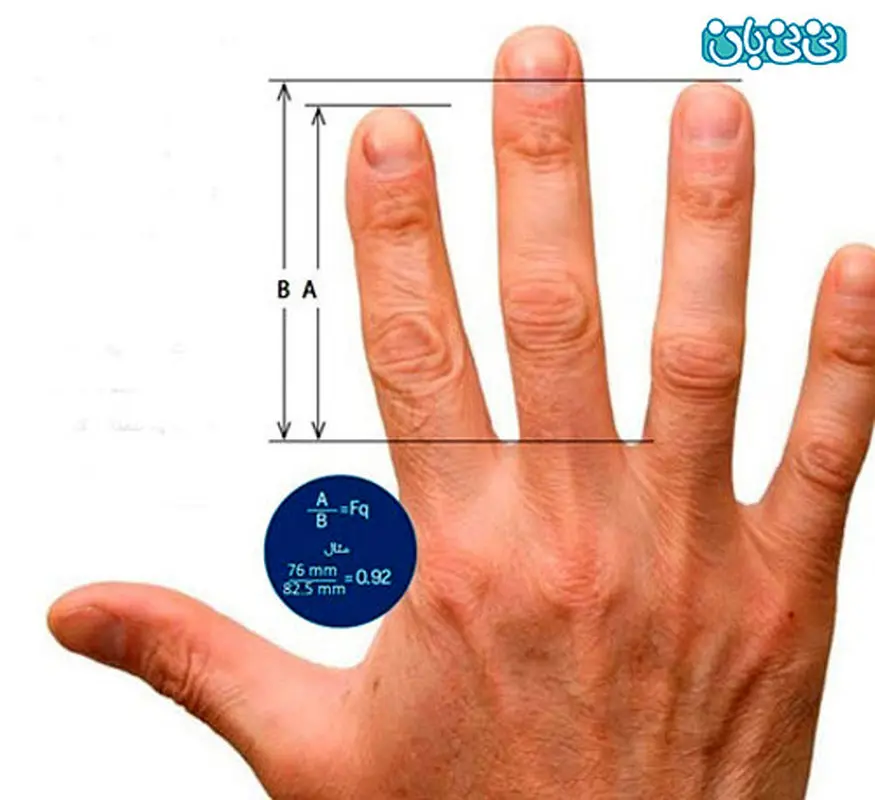 تشخیص علائم بیماری، کف بینی سلامتی!