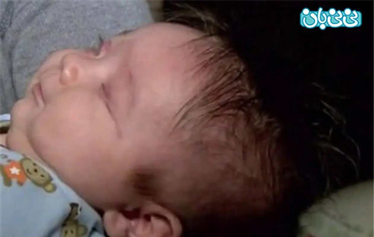 تولد نوزاد بدون چشم، درمان میشود؟