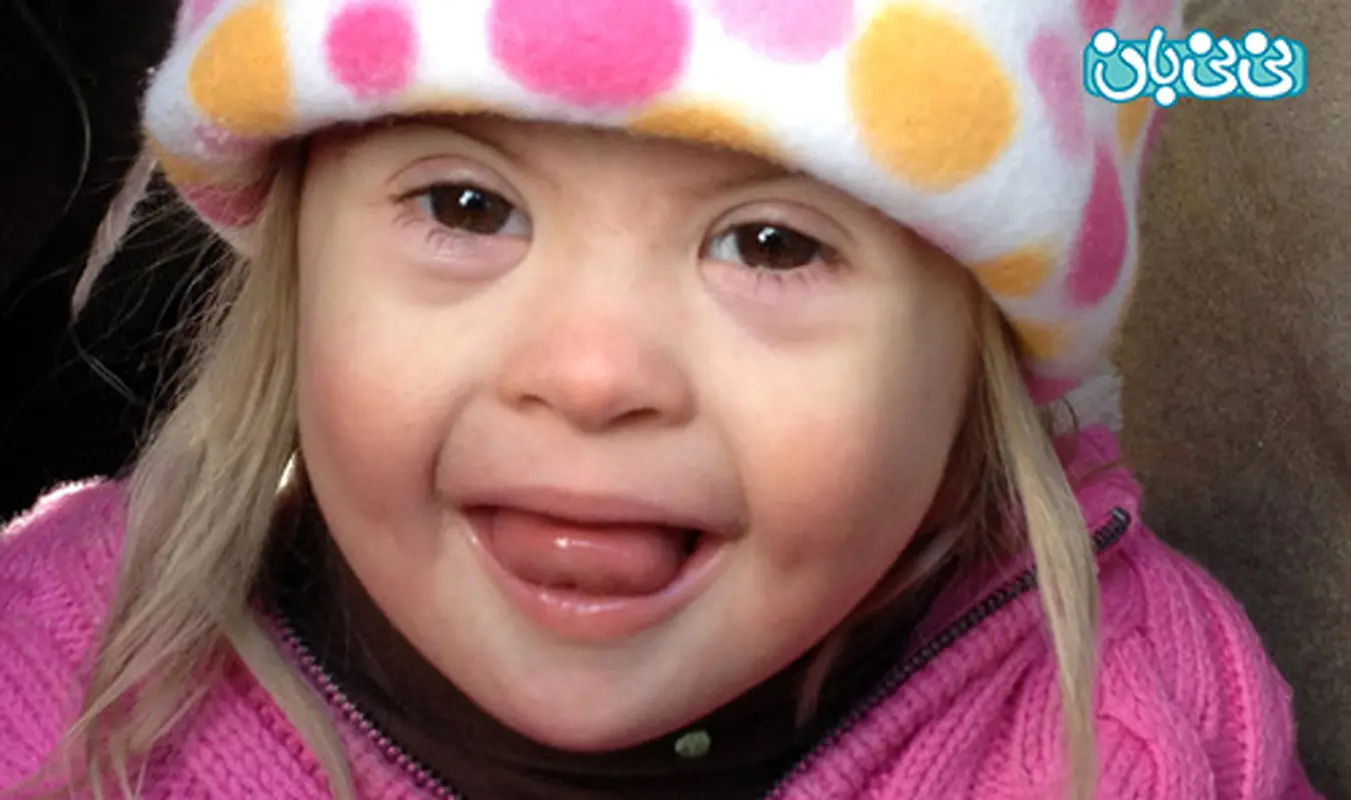 کم توانی ذهنی کودکان، راه پیشگیری دارد؟