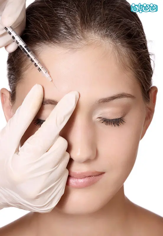 ژل بوتاکس صورت، سوالات زنان