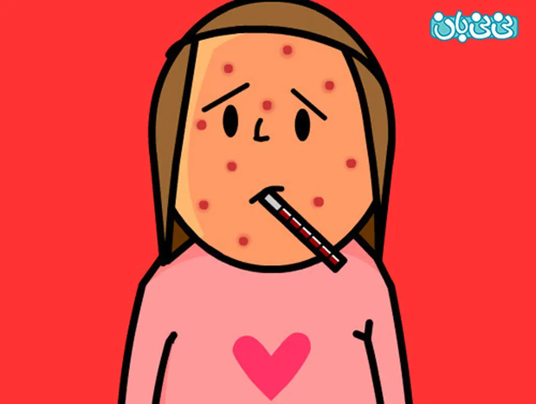 داستانهای کوتاه کودکانه، سرایت آبله مرغان!