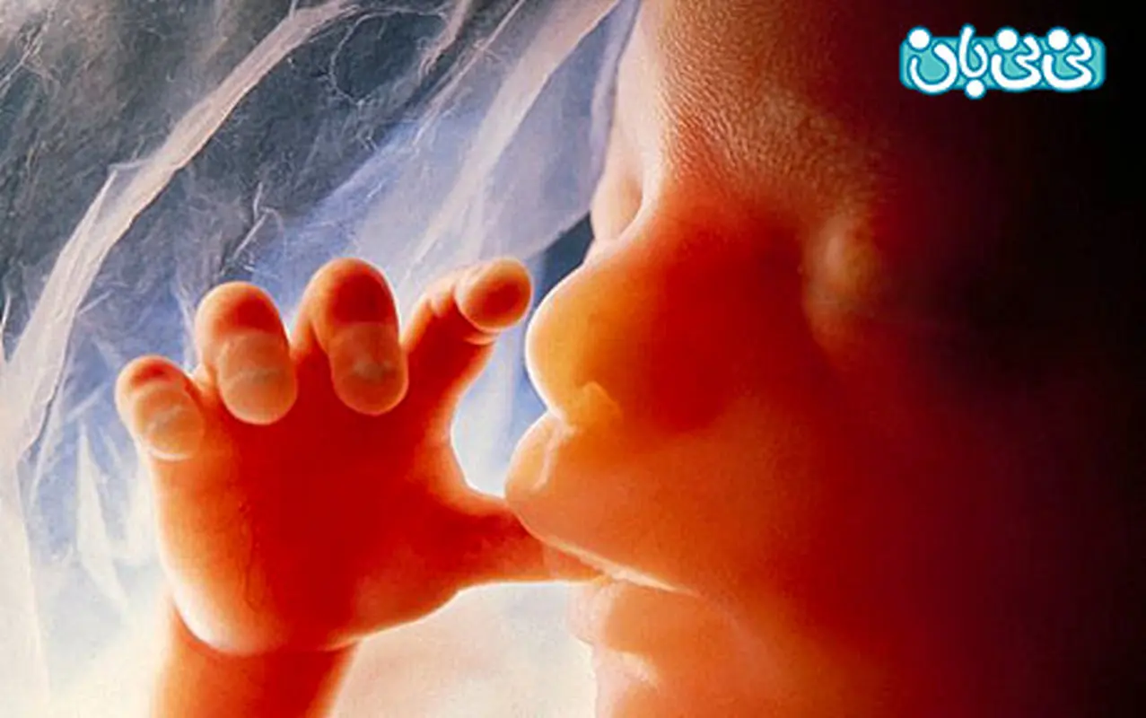 سقط جنین، از علت تا درمان