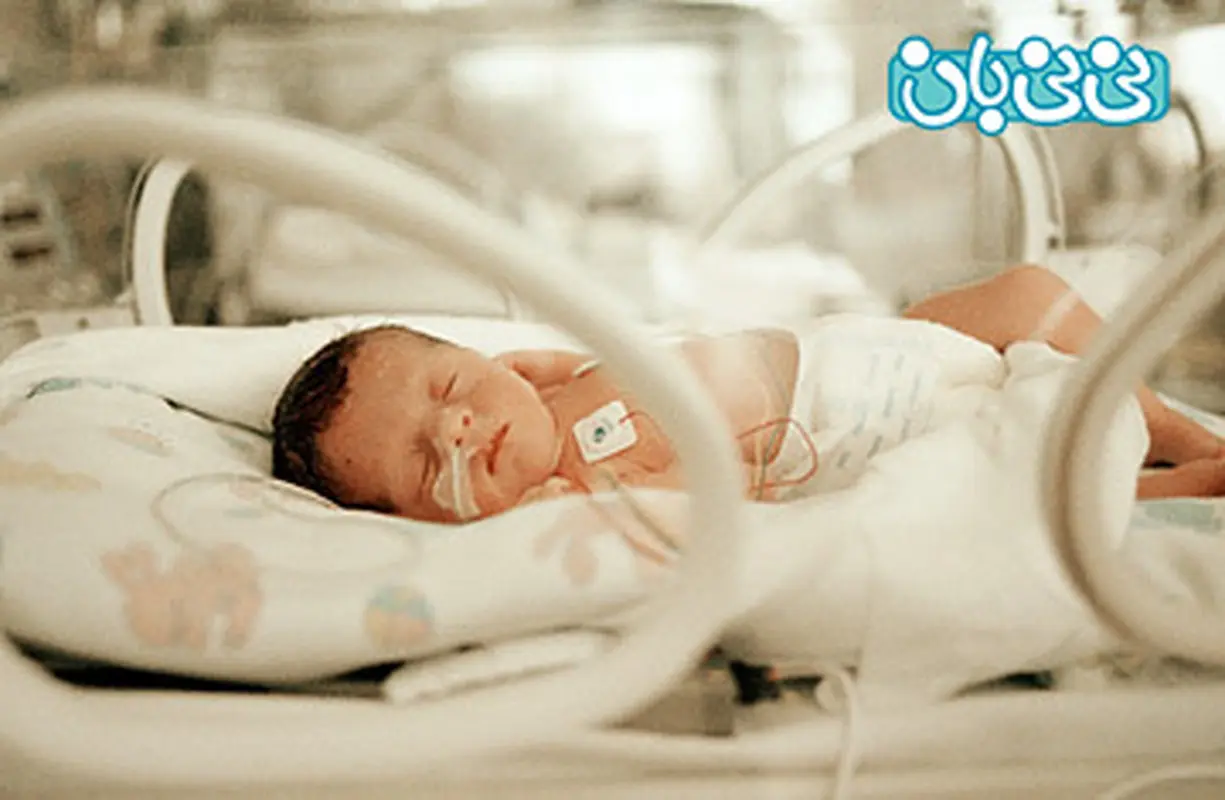 زایمان زودرس