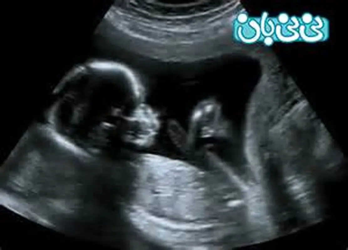 حرکات جنین در رحم، از سه ماهه اول تا سوم (3)