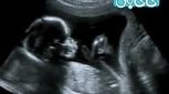 حرکات جنین در رحم، از سه ماهه اول تا سوم (3)