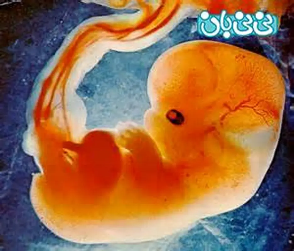 کنترل حرکات جنین در رحم (5)