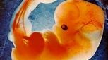 کنترل حرکات جنین در رحم (5)