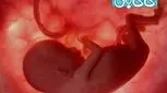 کاهش حرکات جنین در رحم (7)