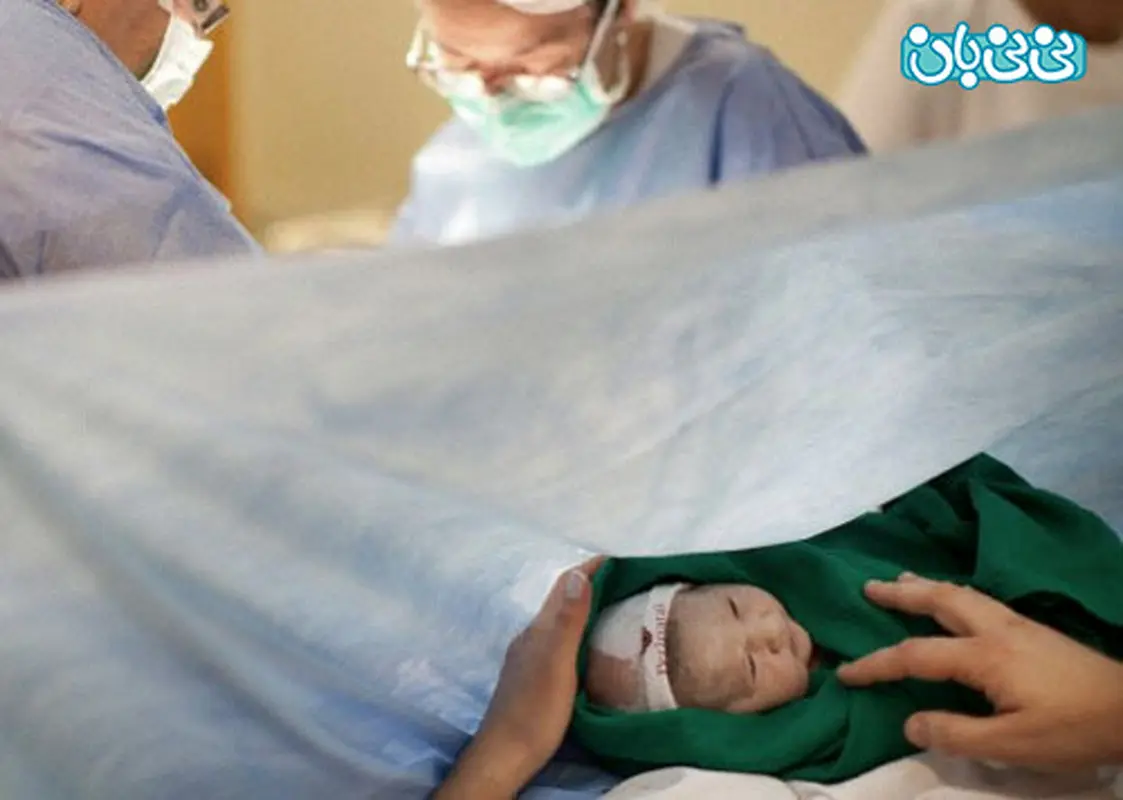 کاهش آمار سزارین در ایران (2)