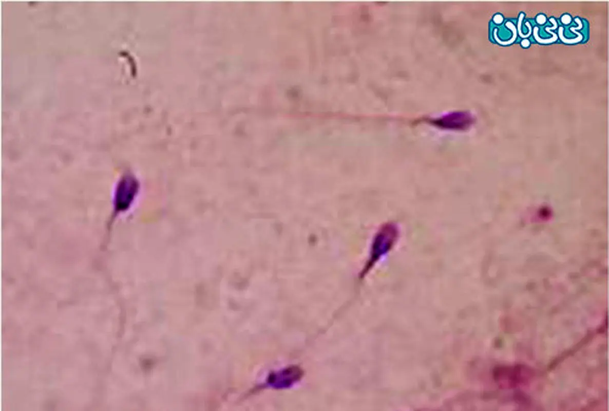 آزمایش تشخیص ناباروری