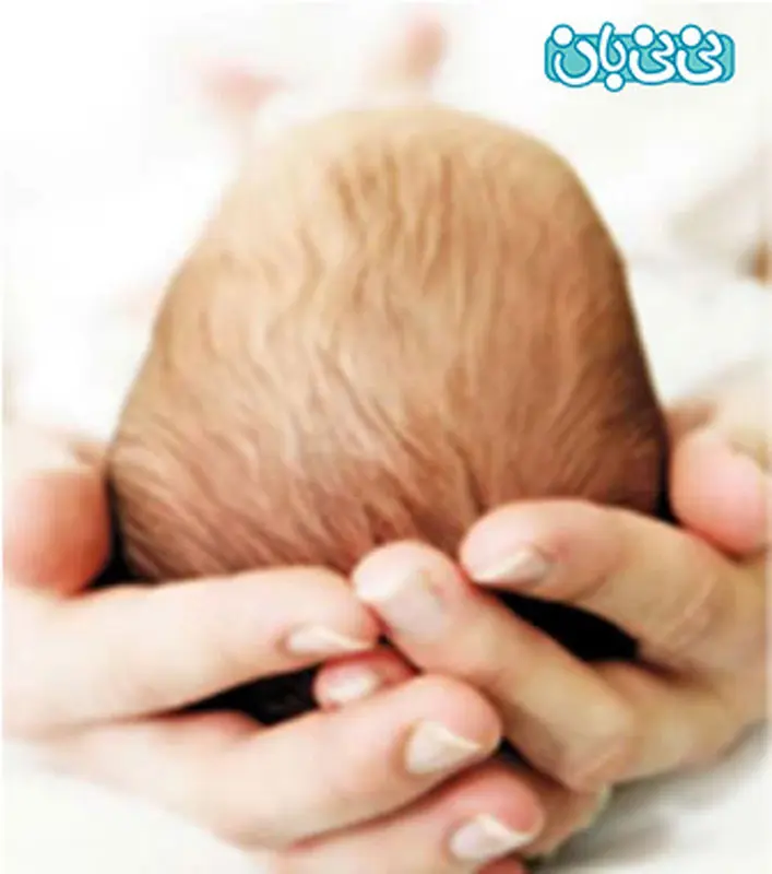 پهن شدن سر نوزاد، پدیده‌ای شایع