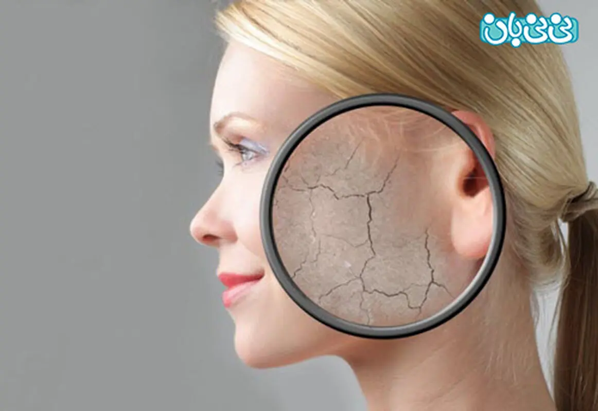 تاثیر صابون بر زنان، پوست خشک دارید؟
