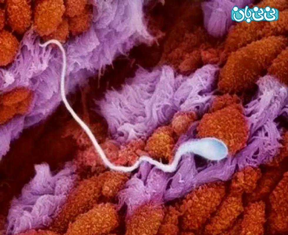 لقاح خارج رحمی چیست؟