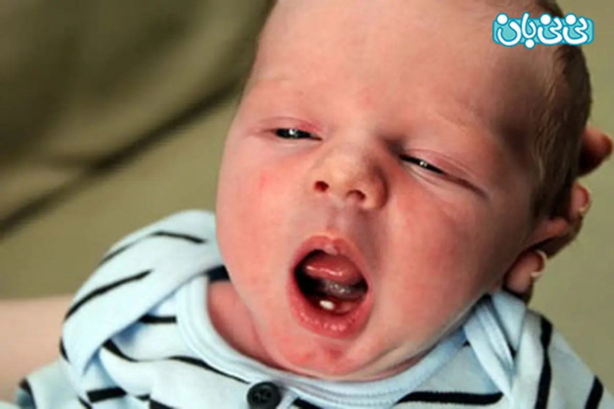تسکین درد دندان درآوردن نوزاد