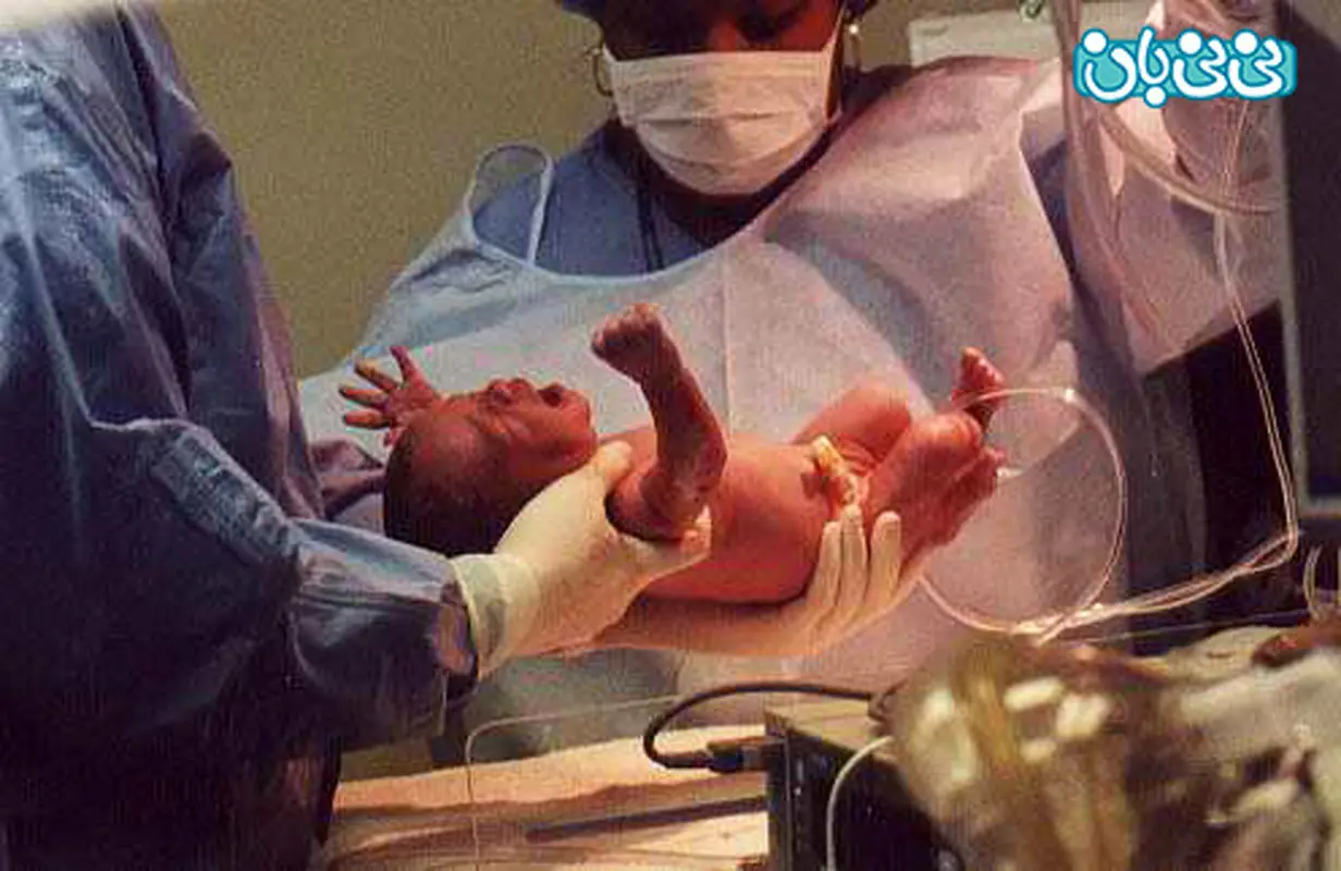 فقط طبیعی زایمان کنید مگر...