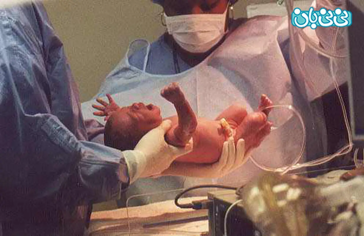 فقط طبیعی زایمان کنید مگر...