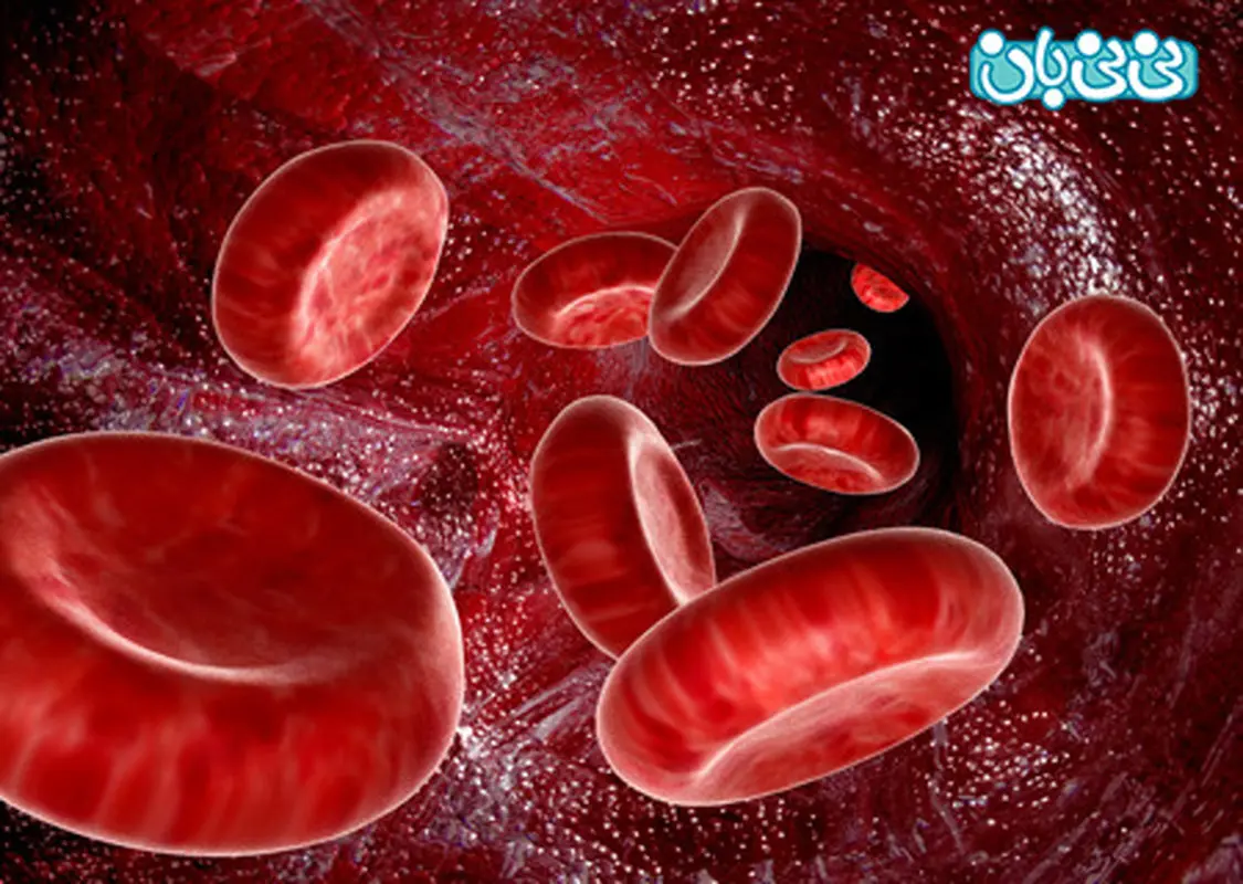 علل کم خونی در زنان، آیا بیماری است؟