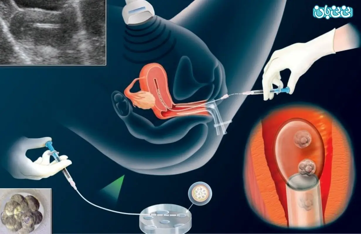 برای پسردار شدن کی نزدیکی کنیم؟