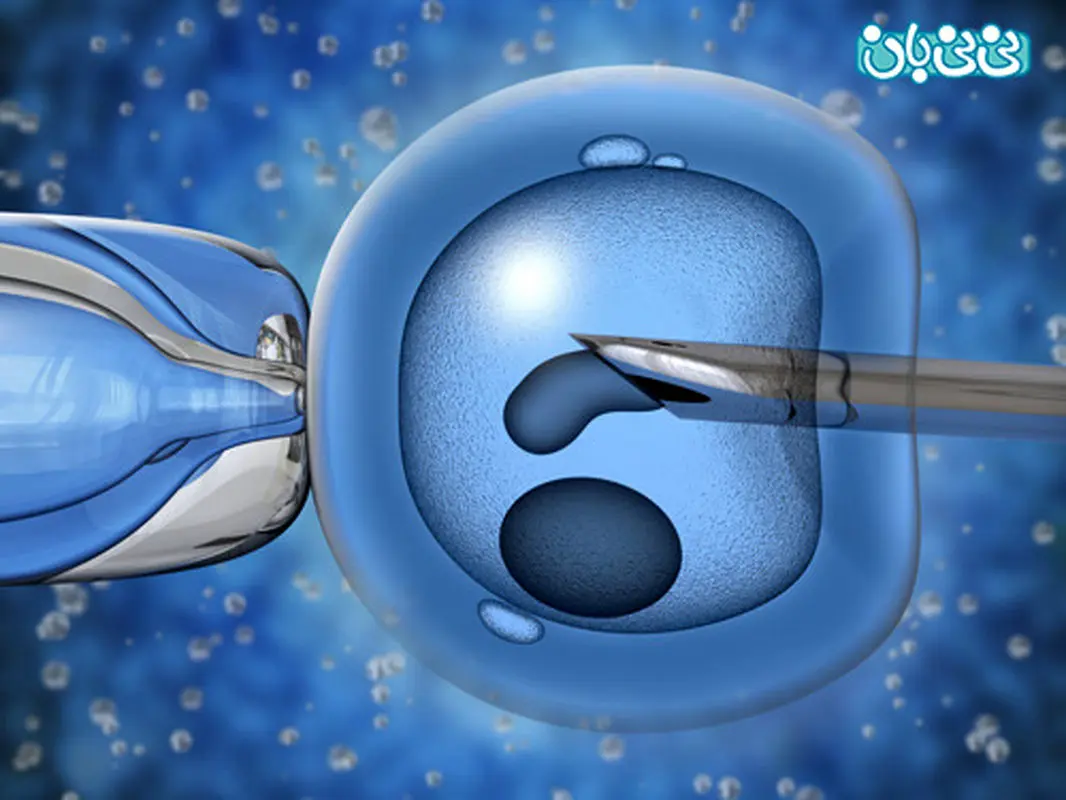 فولیکول کدام تخمدان مرا پسردار می کند؟