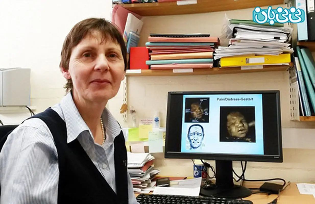 تصاویر سونوگرافی از جنین، هنگام سیگار کشیدن مادر