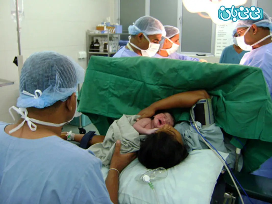 سزارین را چندبار می‌توان انجام داد؟