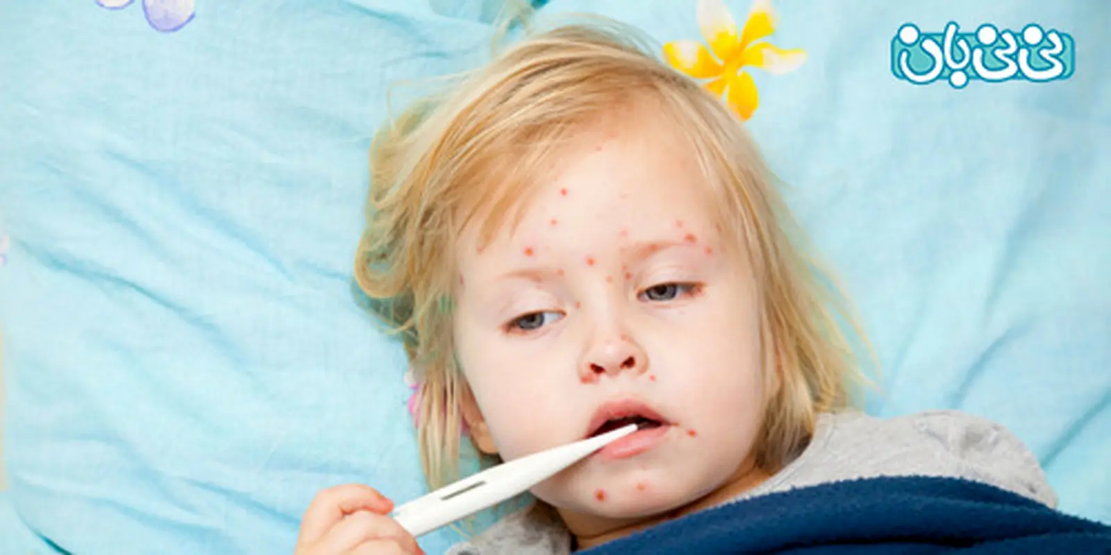 بیماری های واگیردار در کودکان، بیشتر بدانید