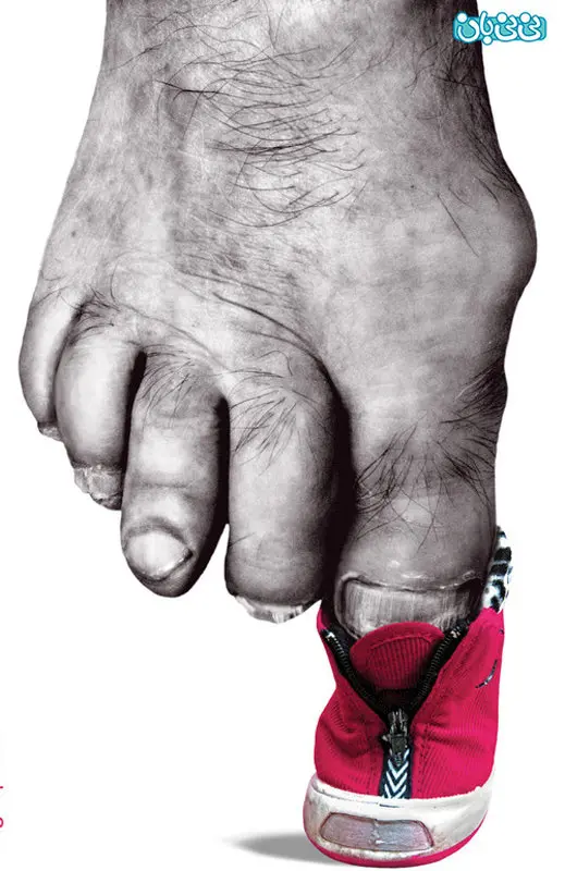 آزار فیزیکی کودکان، مصادیق و پیشگیری