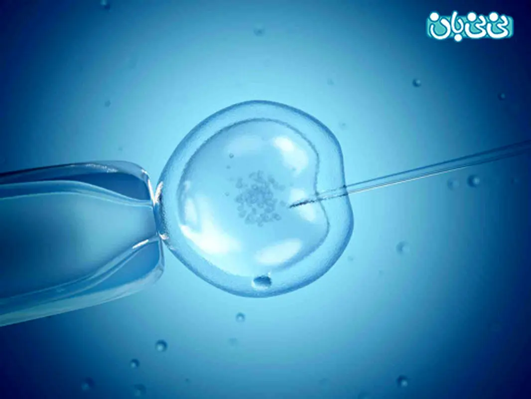 درمان نازایی با IVF