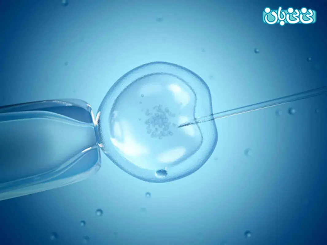 درمان نازایی‌ با IVF