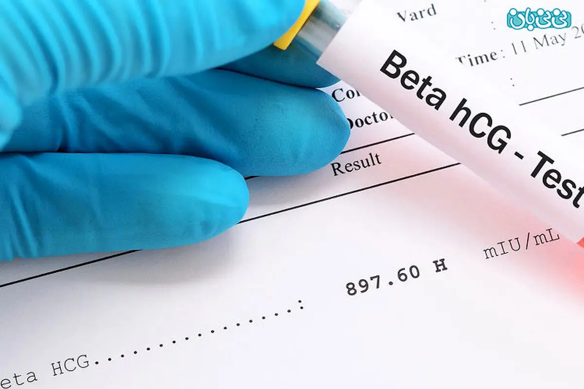 قبل از تاخیر پریود از کجا بفهمم باردارم؟