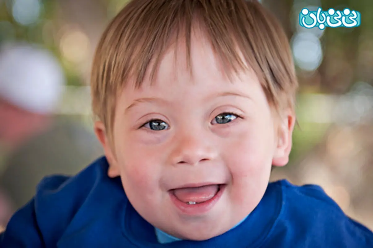 سندروم داون در نوزادان، دلایل ابتلا