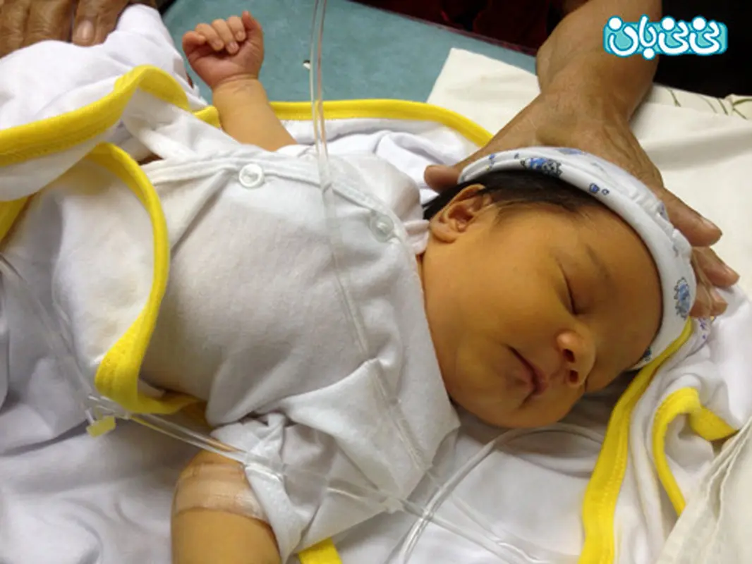 زردی نوزادان در بدو تولد، خطرناک است؟