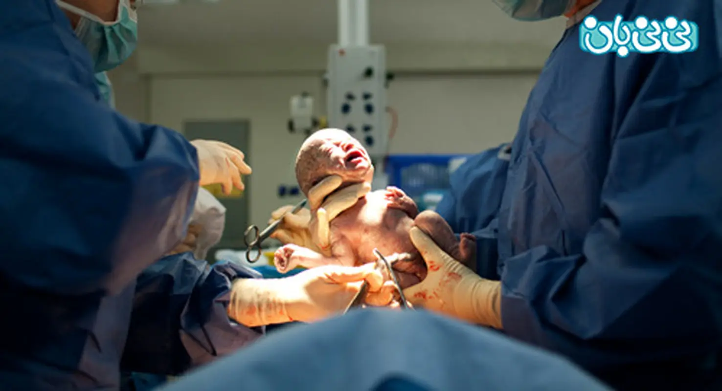 سزارین چه مضراتی دارد؟