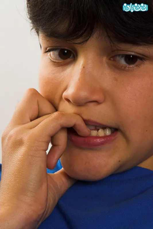 ناخن جویدن در کودکان، علت چیست؟