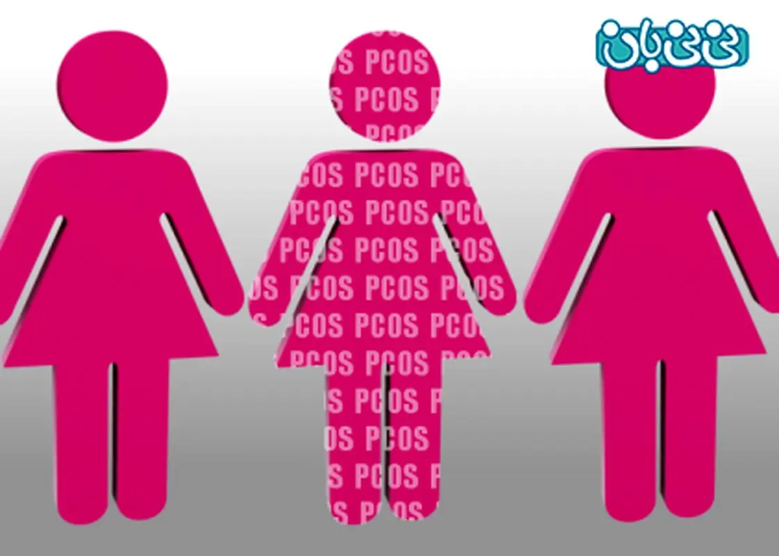 تنبلی تخمدان چیست؟ (1)