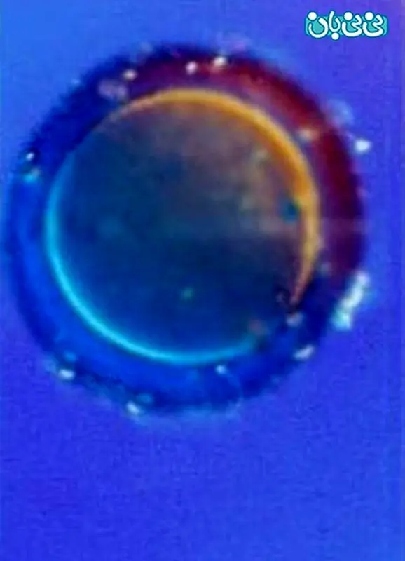 تصویری/مراحل رشد جنین انسان