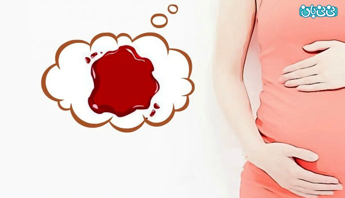 لکه های قهوه ای در هفته بارداری خطرناک است؟