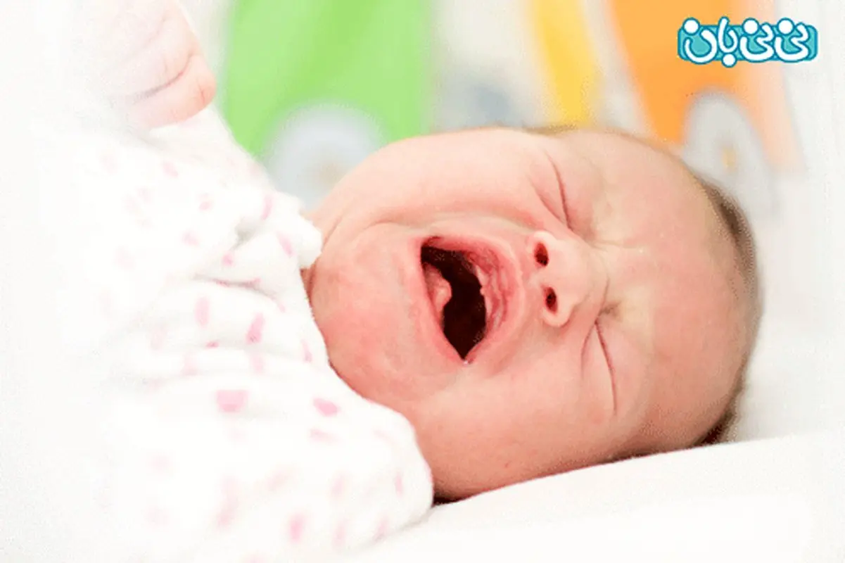 ریفلاکس معده در نوزادان (2)