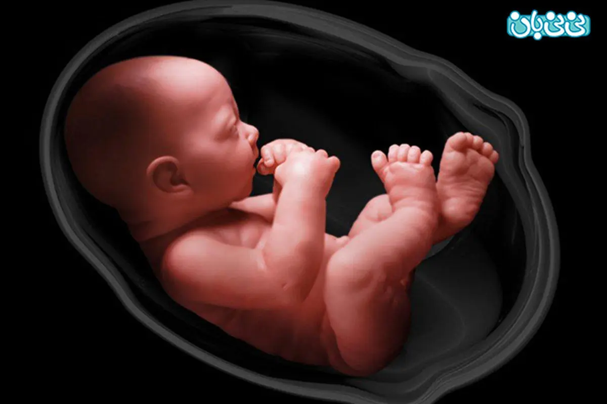 ورم کلیه جنین قابل درمان است